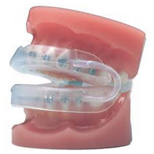 Masel Braces Mouthguard Youth - Suplay.com